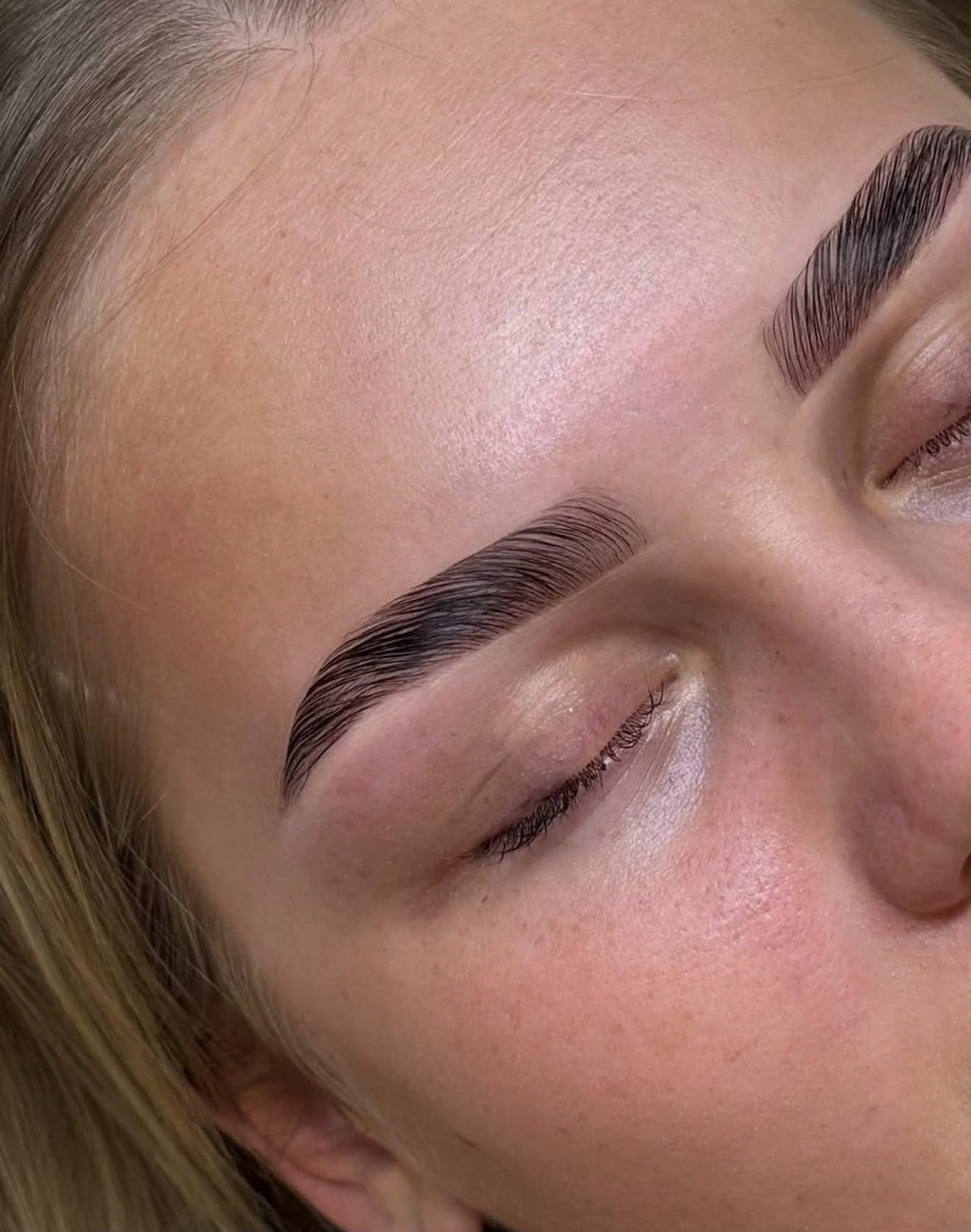 Browlamination